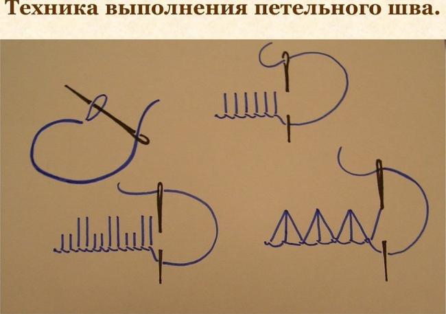 Техника выполнения петельного шва